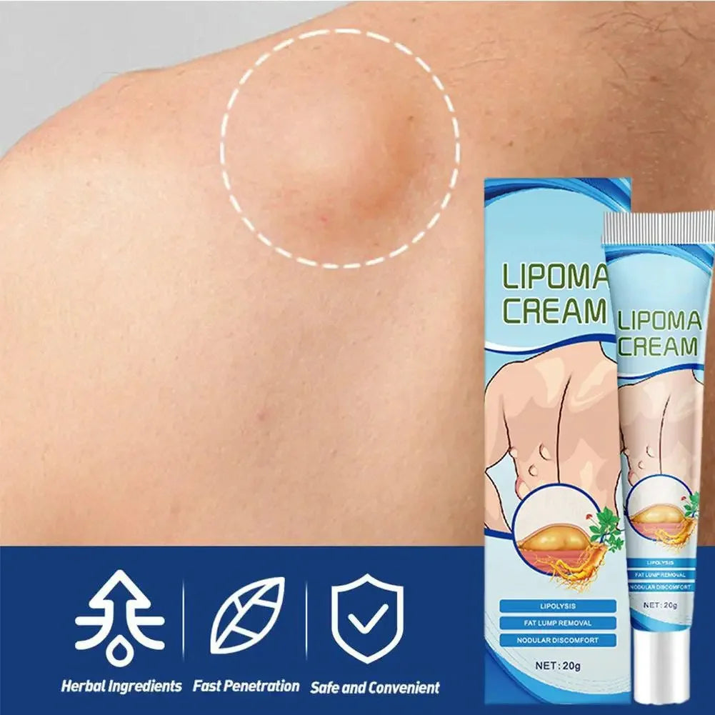 Lipoma Removal Cream