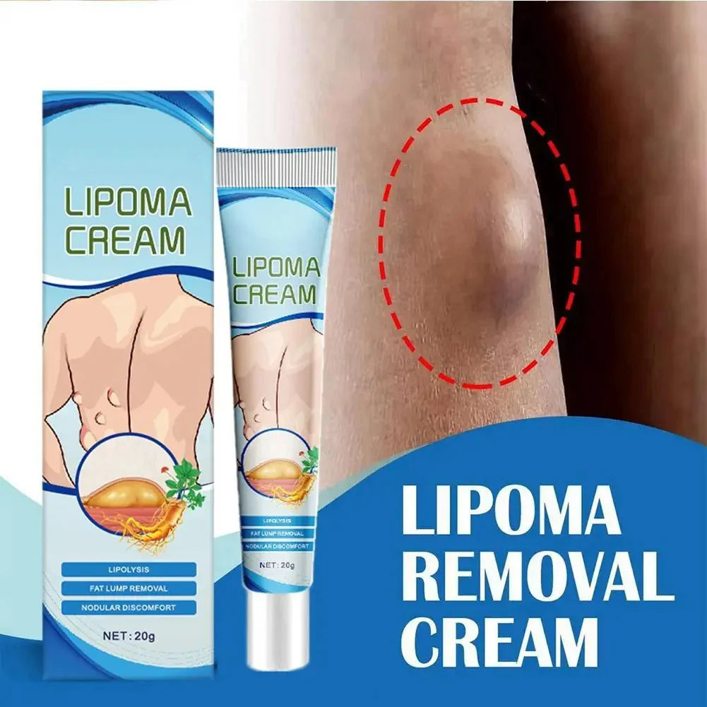 Lipoma Removal Cream