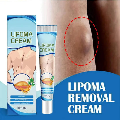 Lipoma Removal Cream